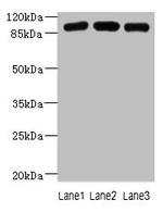 ASAP3 Antibody in Western Blot (WB)