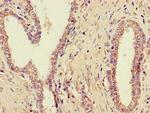 ZDHHC1 Antibody in Immunohistochemistry (Paraffin) (IHC (P))