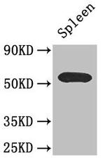 ZDHHC1 Antibody in Western Blot (WB)