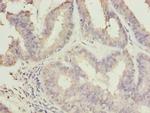 C10orf82 Polyclonal Antibody