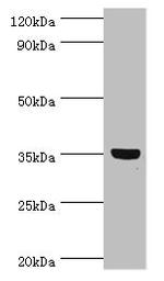 GLYATL1 Antibody in Western Blot (WB)