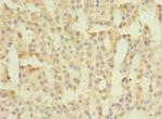 FAM149B1 Antibody in Immunohistochemistry (Paraffin) (IHC (P))