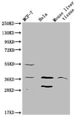 MRGPRX2 Antibody in Western Blot (WB)