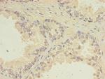CEP63 Polyclonal Antibody