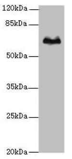 TBX15 Polyclonal Antibody