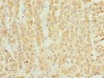 ELMOD1 Polyclonal Antibody