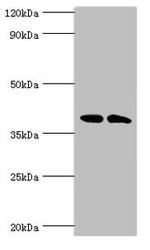 CSNK1A1L Antibody in Western Blot (WB)