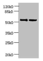 UTP15 Polyclonal Antibody