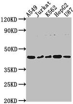 DNASE2B Polyclonal Antibody
