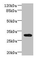 CCDC127 Polyclonal Antibody