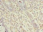 RTP4 Antibody in Immunohistochemistry (Paraffin) (IHC (P))