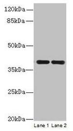 CCDC42 Antibody in Western Blot (WB)