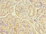 TBC1D19 Polyclonal Antibody