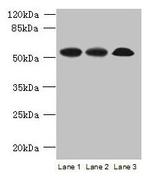 SPERT Polyclonal Antibody
