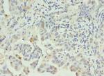CLEC1A Polyclonal Antibody