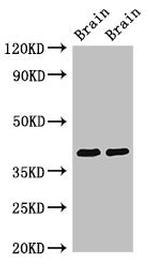 STOML3 Antibody in Western Blot (WB)