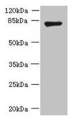 FBXO30 Antibody in Western Blot (WB)