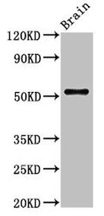 ASZ1 Antibody in Western Blot (WB)