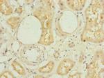 L3HYPDH Polyclonal Antibody