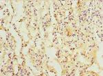 L3HYPDH Antibody in Immunohistochemistry (Paraffin) (IHC (P))