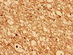 CHMP6 Polyclonal Antibody