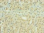 HYLS1 Polyclonal Antibody