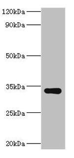 HYLS1 Antibody in Western Blot (WB)