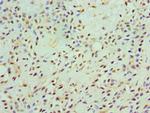 CaMKI gamma Antibody in Immunohistochemistry (Paraffin) (IHC (P))