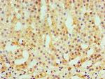 CaMKI gamma Polyclonal Antibody