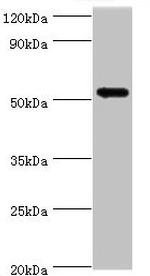 CaMKI gamma Antibody in Western Blot (WB)