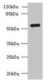 SLC38A2 Antibody in Western Blot (WB)