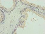 VWA9 Polyclonal Antibody