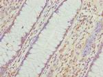 VWA9 Antibody in Immunohistochemistry (Paraffin) (IHC (P))