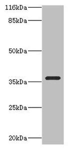 CA13 Antibody in Western Blot (WB)
