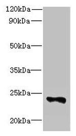 FA156 Antibody in Western Blot (WB)