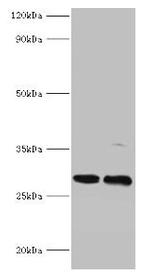 PIGX Antibody in Western Blot (WB)