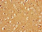 FBXO25 Antibody in Immunohistochemistry (Paraffin) (IHC (P))