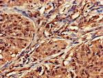 Dot1L Antibody in Immunohistochemistry (Paraffin) (IHC (P))
