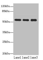TBC1D22A Polyclonal Antibody