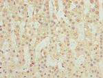 RUFY2 Polyclonal Antibody