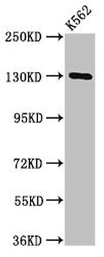SorCS1 Antibody in Western Blot (WB)