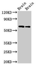 CPNE4 Antibody in Western Blot (WB)