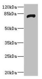 HHIP Antibody in Western Blot (WB)