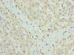 CLYBL Antibody in Immunohistochemistry (Paraffin) (IHC (P))