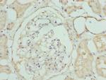 CLYBL Polyclonal Antibody