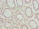 CLYBL Antibody in Immunohistochemistry (Paraffin) (IHC (P))