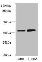 CLYBL Antibody in Western Blot (WB)
