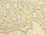 NHLRC2 Polyclonal Antibody