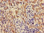 ACMSD Antibody in Immunohistochemistry (Paraffin) (IHC (P))