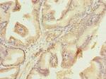 Plet1 Antibody in Immunohistochemistry (Paraffin) (IHC (P))